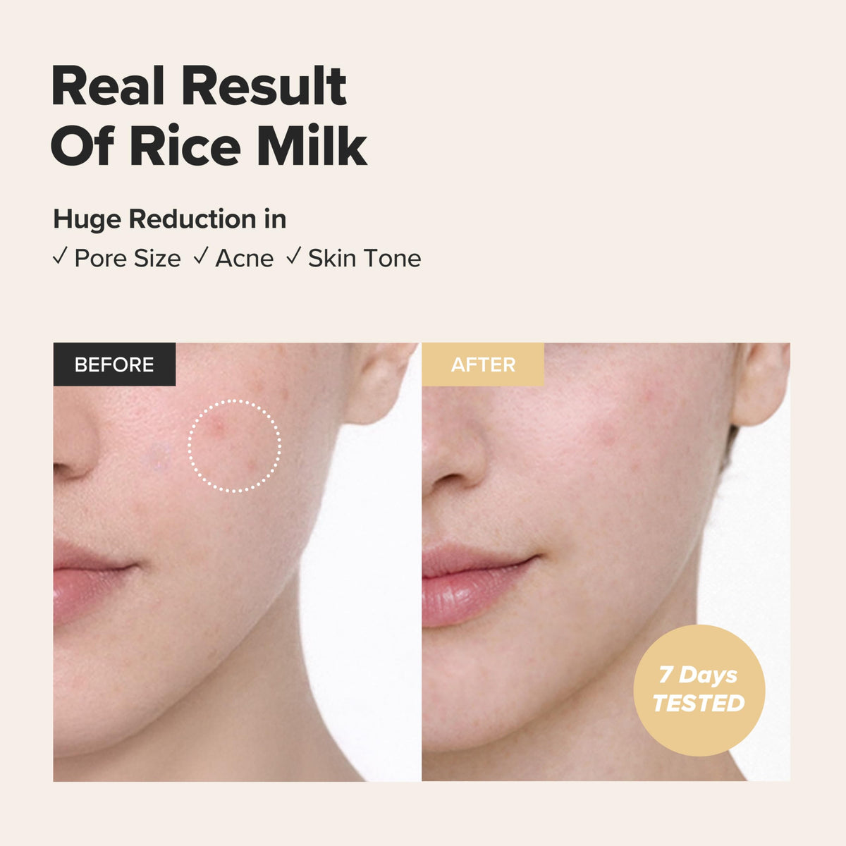 Beauty of Joseon Glow Replenishing Rice Milk Toner Deep Hydration and Oil Control with Rice Extract Hydrating Korean Milky Toner for All Skin Types, 150ml